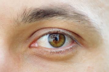 A close-up image of a person's eye.