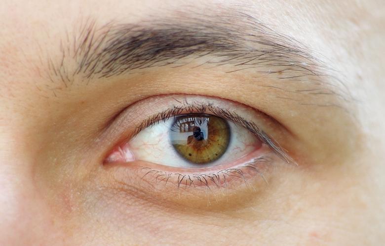 A close-up image of a person's eye.